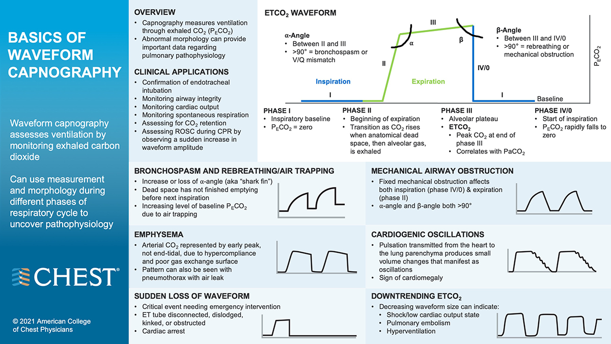1200 capnography